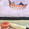 Medit i900 Intraoral Scanner